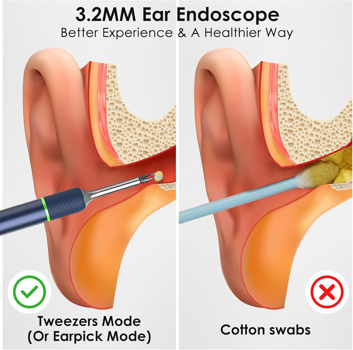 Ear Wax Removal Tool Camera with 10 Megapixels, 12 Ear Spoons, 2 Modes Y112058